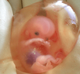Difference between Zygote, Embryo and Fetus