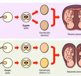 Difference between Monozygotic and Dizygotic Twins